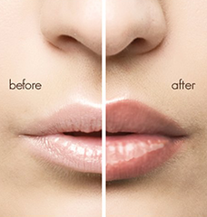 Instant Hotlipz Lip Plumping Serum